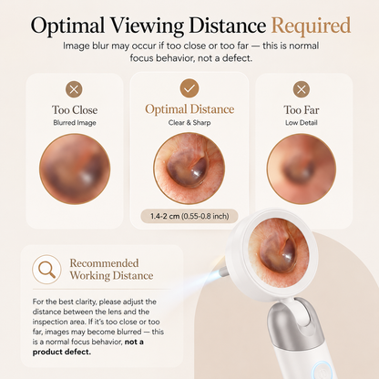 Velnora Digital Otoscope with LED Light